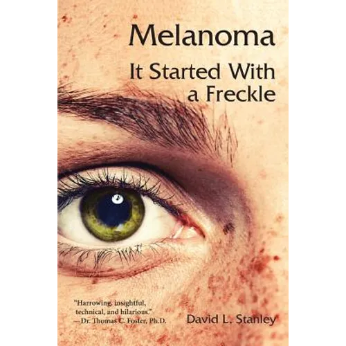 Melanoma: It Started With a Freckle