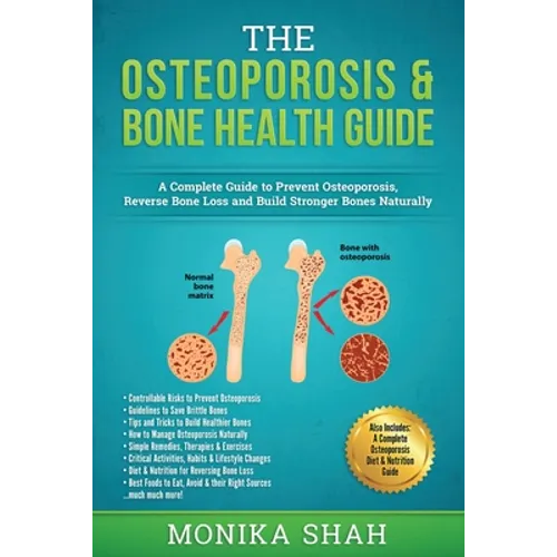 Osteoporosis: The Osteoporosis & Bone Health Guide: A Complete Guide to Prevent Osteoporosis, Reverse Bone Loss and Build Stronger Bones Naturally