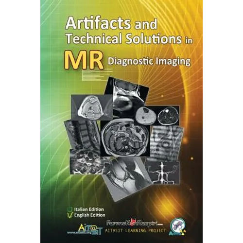 Artifacts and Technical Solutions in MR Diagnostic Imaging