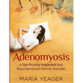 Adenomyosis: A Significantly Neglected and Misunderstood Disorder