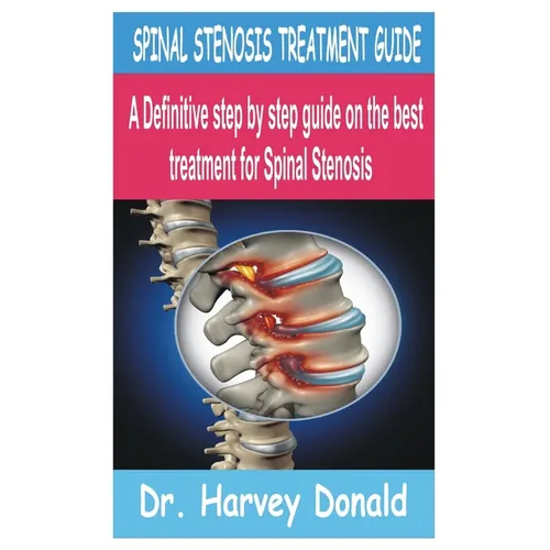 Spinal Stenosis Treatment Guide: A Definitive step by step guide on the best treatment for Spinal Stenosis