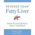 Reverse Your Fatty Liver: How To Naturally Heal Yourself