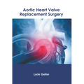 Aortic Heart Valve Replacement Surgery