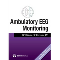 Ambulatory Eeg Monitoring
