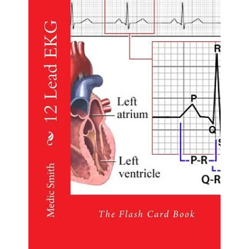 12 Lead EKG: The Flash Card Book