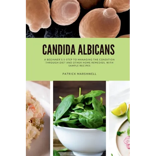 Candida Albicans: A Beginner's 5-Step to Managing the Condition Through Diet and Other Home Remedies, With Sample Recipes