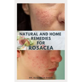 Natural and Home Remedies for Rosacea: A Self Help Guide To Completely Prevent and Treat Rosacea