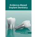 Evidence-Based Implant Dentistry