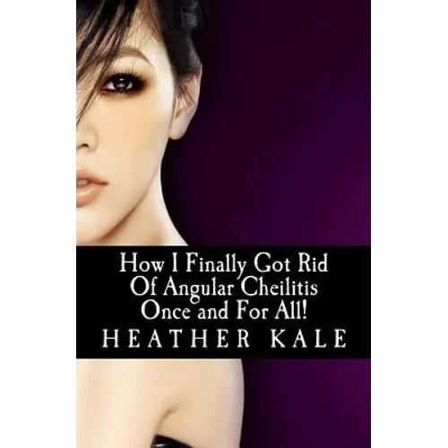 How I Finally Got Rid Of Angular Cheilitis Once and For All!: Cracked Mouth Corners No More