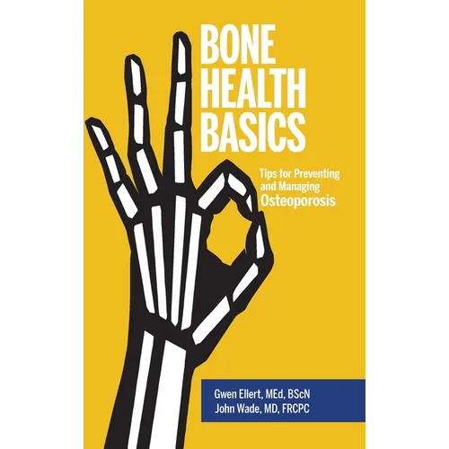 Bone Health Basics: Tips for Preventing and Managing Osteoporosis