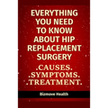 Everything you need to know about Hip Replacement Surgery: Causes, Symptoms, Treatment