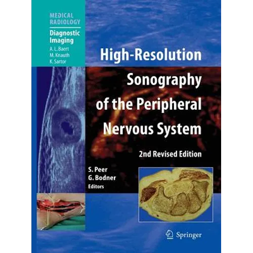 High-Resolution Sonography of the Peripheral Nervous System