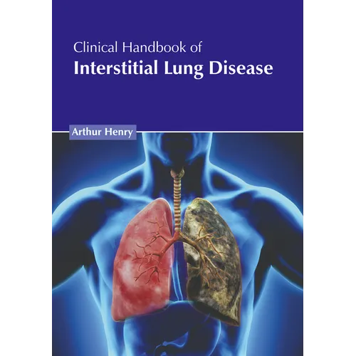 Clinical Handbook of Interstitial Lung Disease