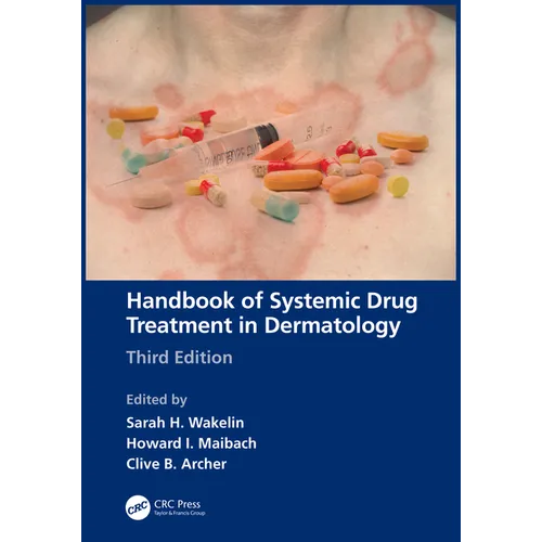Handbook of Systemic Drug Treatment in Dermatology