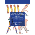 Tips and Tricks in Endovascular Surgery: A How to Guide for Reaching the Next Level in Endovascular Surgery
