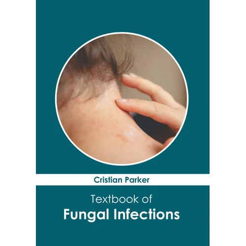 Textbook of Fungal Infections