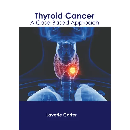 Thyroid Cancer: A Case-Based Approach