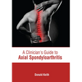 A Clinician's Guide to Axial Spondyloarthritis