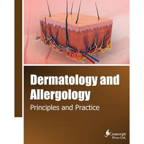 Dermatology and Allergology: Principles and Practice