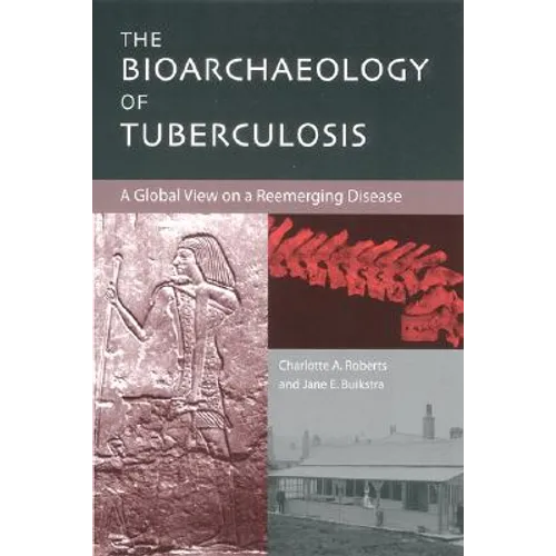 The Bioarchaeology of Tuberculosis: A Global View on a Reemerging Disease