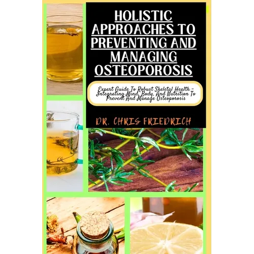 Holistic Approaches to Preventing and Managing Osteoporosis: Expert Guide To Robust Skeletal Health - Integrating Mind, Body, And Nutrition To Prevent