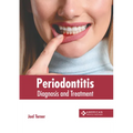 Periodontitis: Diagnosis and Treatment