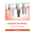Implant Dentistry: Clinical Cases