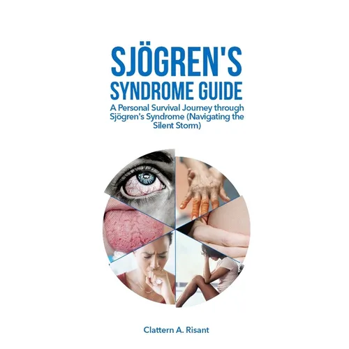 Sjögren's Syndrome Guide: A Personal Survival Journey through Sjögren's Syndrome (Navigating the Silent Storm)