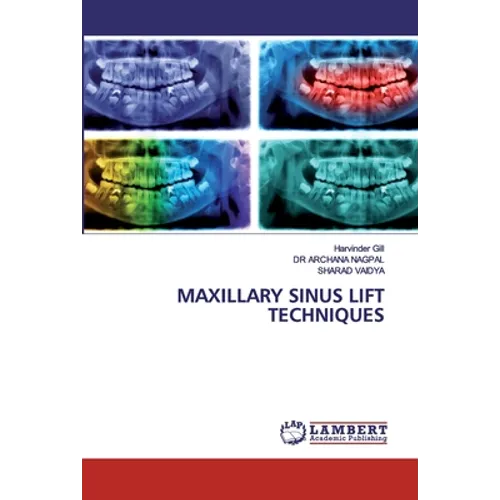 Maxillary Sinus Lift Techniques