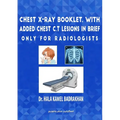 Chest X-Ray Booklet, with added Chest C.T Lesions in brief Only for Radiologists