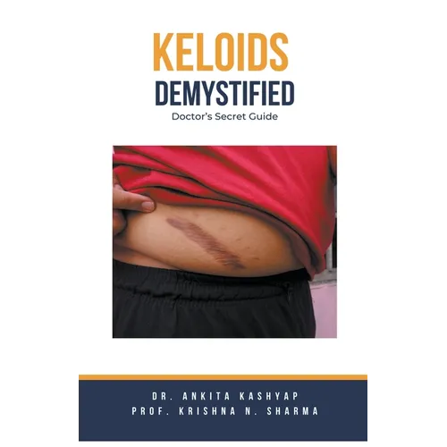 Keloids Demystified: Doctor's Secret Guide