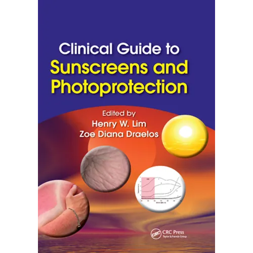 Clinical Guide to Sunscreens and Photoprotection