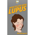 How To Live With Lupus: Your Step By Step Guide To Living With Lupus