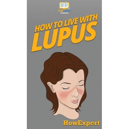 How To Live With Lupus: Your Step By Step Guide To Living With Lupus