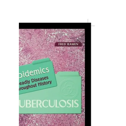 Tuberculosis