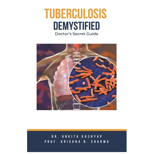 Tuberculosis Demystified: Doctor's Secret Guide