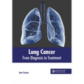 Lung Cancer: From Diagnosis to Treatment