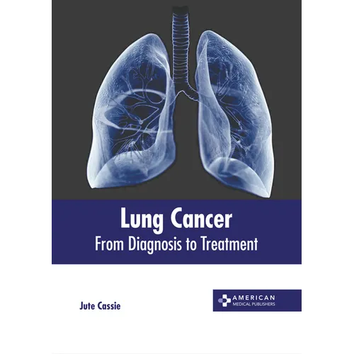 Lung Cancer: From Diagnosis to Treatment