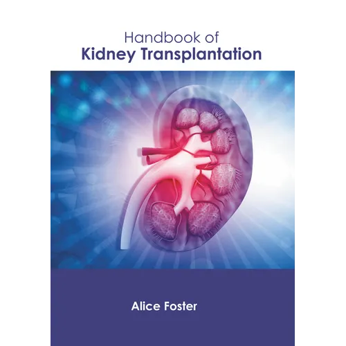 Handbook of Kidney Transplantation