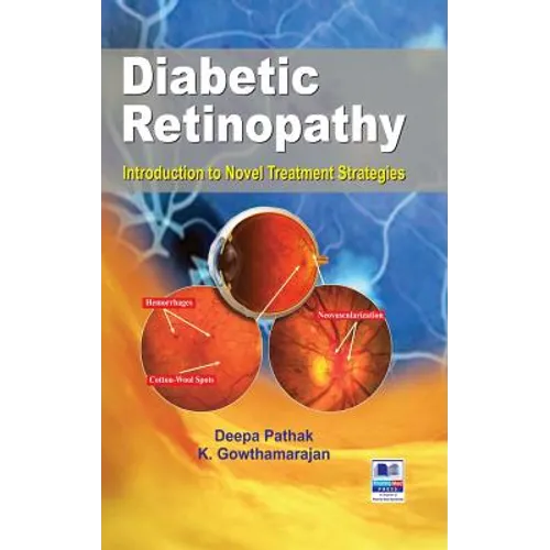 Diabetic Retinopathy: Introduction to Novel Treatment Strategies