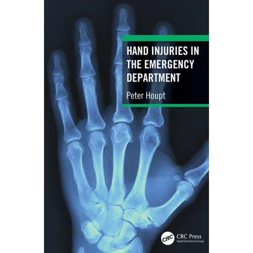 Hand Injuries in the Emergency Department