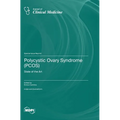 Polycystic Ovary Syndrome (PCOS): State of the Art