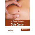A Clinical Guide to Skin Cancer