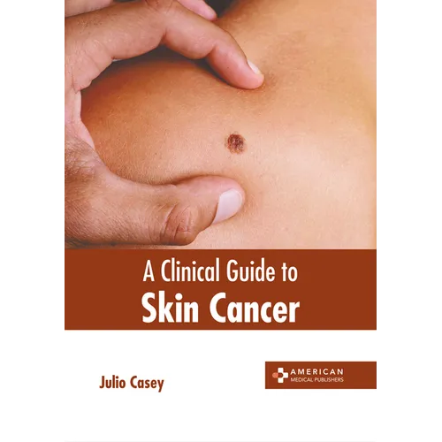 A Clinical Guide to Skin Cancer