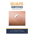 Cellulitis Demystified: Doctor's Secret Guide