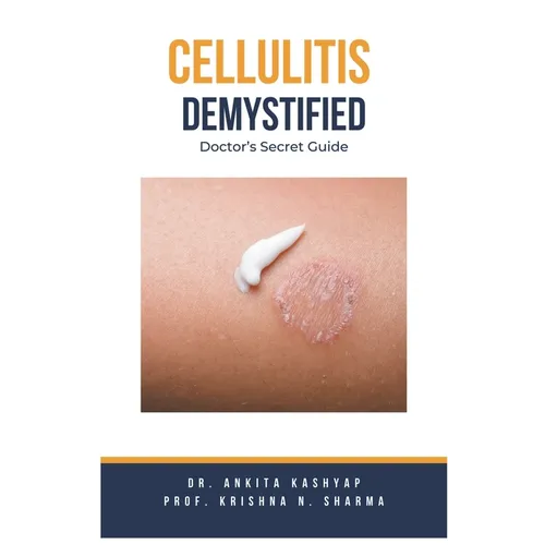 Cellulitis Demystified: Doctor's Secret Guide