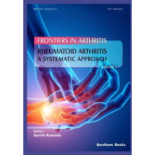 Rheumatoid Arthritis: A systematic approach
