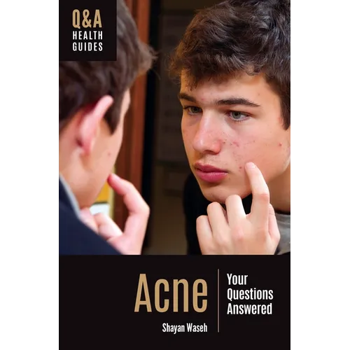 Acne: Your Questions Answered