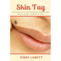 Skin Tag: Natural DIY Methods of removing Mole, Wart and Skin Tag
