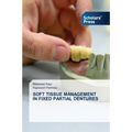 Soft Tissue Management in Fixed Partial Dentures